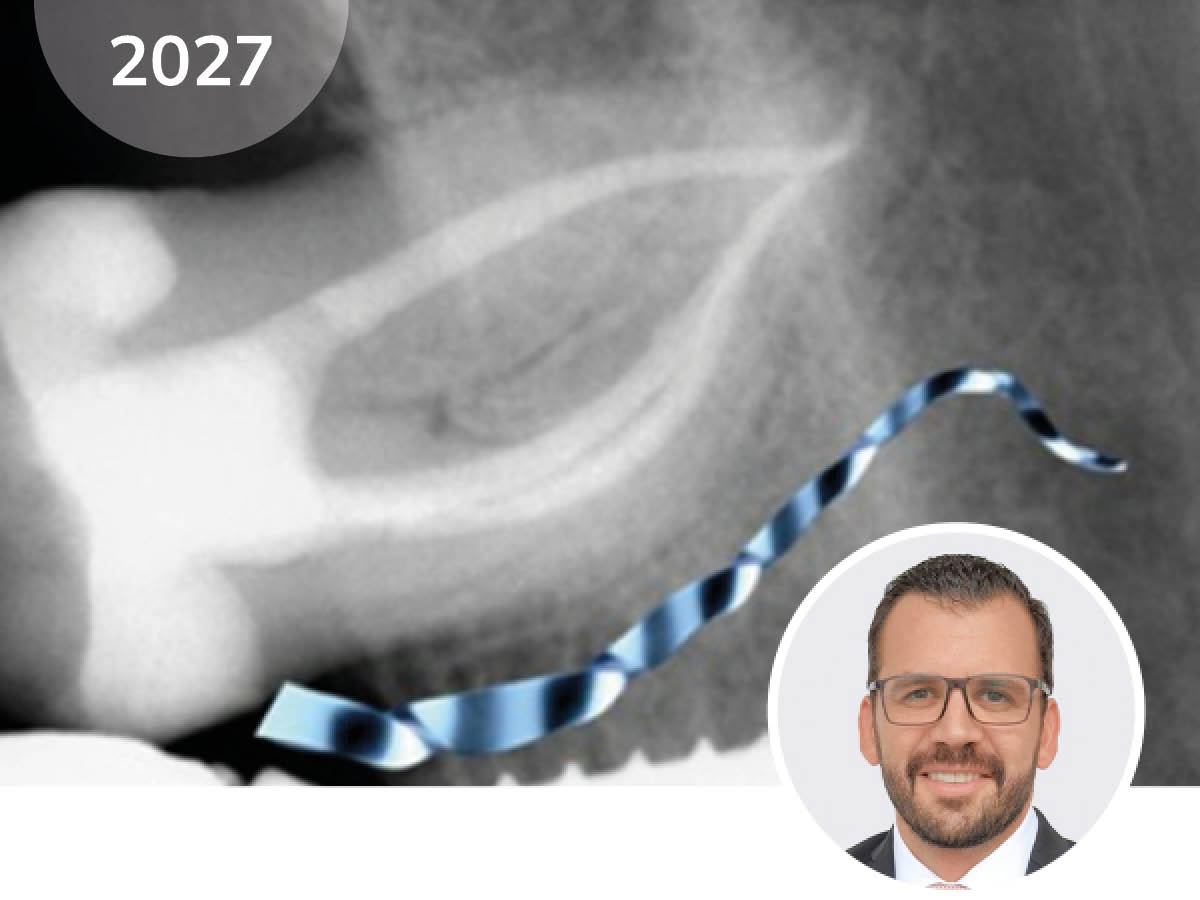 Endo Friday Meeting - Modul II