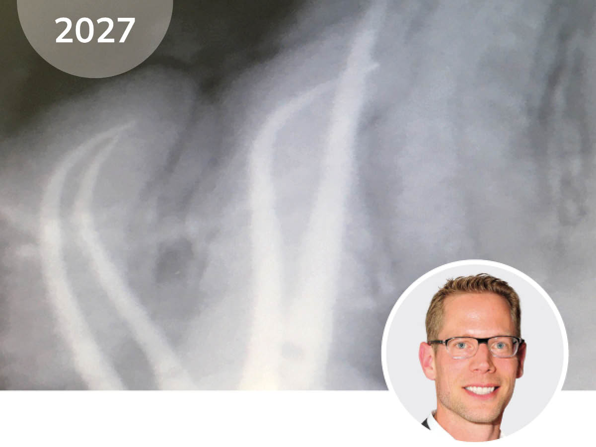 Moderne Endodontie: Einfach, effizient zu guten Ergebnissen