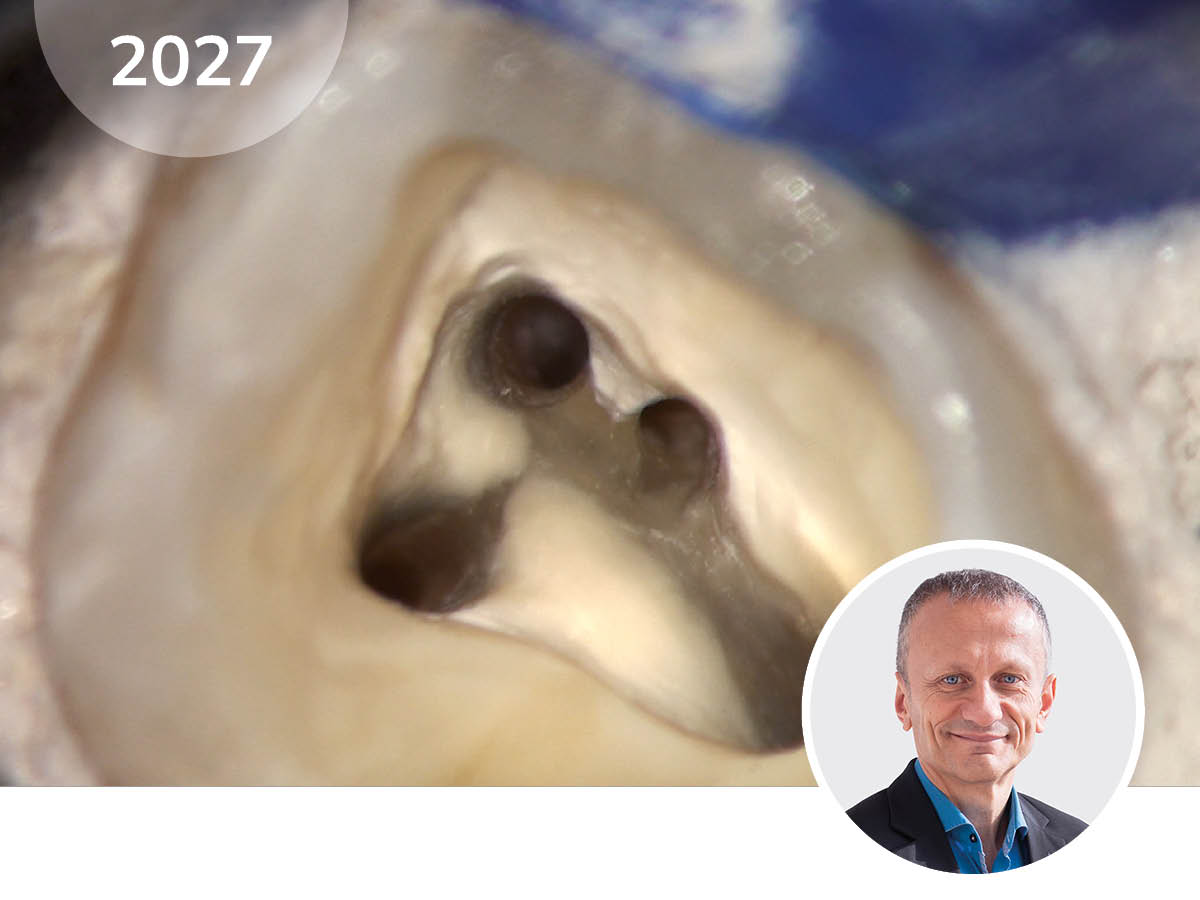 Das Mikroskop in der Endodontie - ein Update