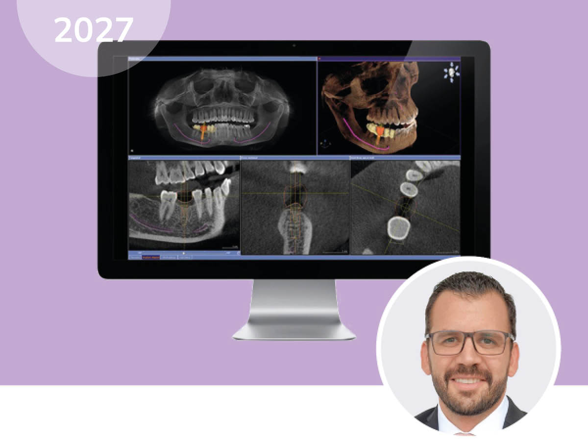 Endo Friday Meeting - Modul I