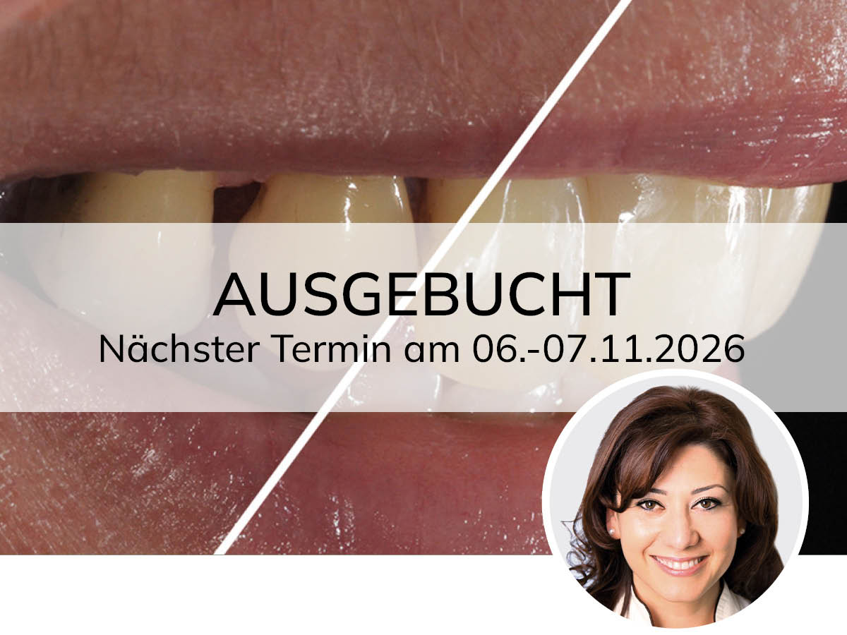 Hochästhetisches, nichtinvasives Komposit-Veneering | 15 - 16.05.2026 | München