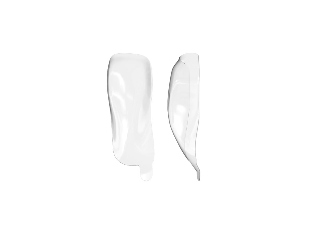 HD Anterior Matrix A-series Shapes, 75µm, A102 - Upper Distal (50)