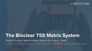 TSS Matrix #7 D – 75 µm (50) 